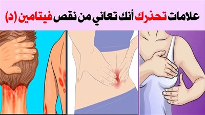أسباب نقص فيتامين د