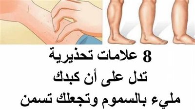 8 علامات تحذيرية تدل على أن كبدك مليء بالتلف