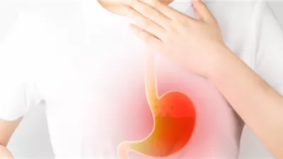 ارتجاع المرئ