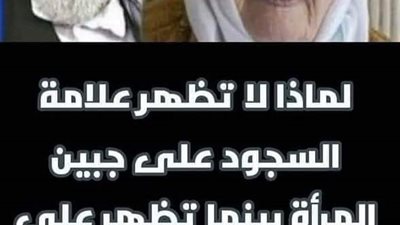 لماذا لا تظهر علامة السجود على جبين المرأة؟