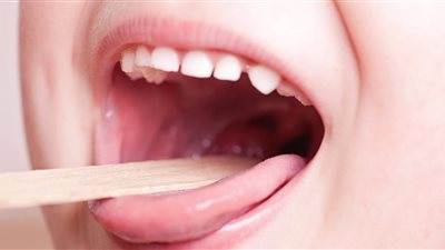 التهاب سقف الحلق أسبابه وعلاجه طبيعيا