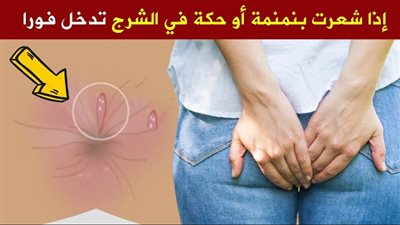 طرق طبيعية ومنزليه لعلاج الحكة الشرجية