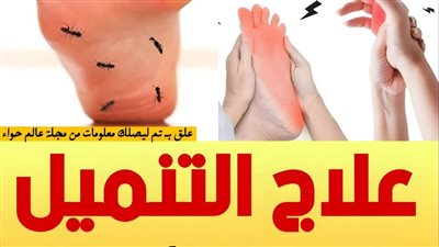 علاج لمشاكل التنميل وضعف الاعصاب في اليد والقدم والظهر💪🏻 فيتامين علاج التهاب وضعف الاعصاب