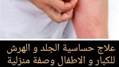 وصفة منزلية سهلة وبسيطة موجودة في كل بيت للتخلص من حساسية الجلد