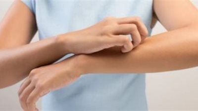 طرق علاج حساسية الجلد والحكة في المنزل