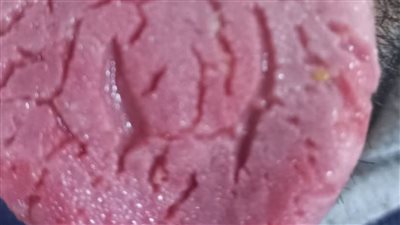 تشققات اللسان الاسباب وطرق العلاج