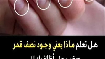 اسباب وجود الاقواس البيضاء ومن خلالها يمكن التعرف على الامړاض ومشاكل في الجسد