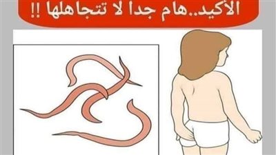 اســهل وأســرع طريقة للتخلص من الدودة البيضاء