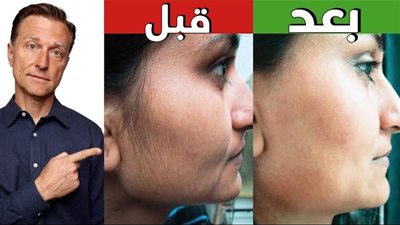 تخفيف شعر الوجه الزائد الغير مرغوب فيه .