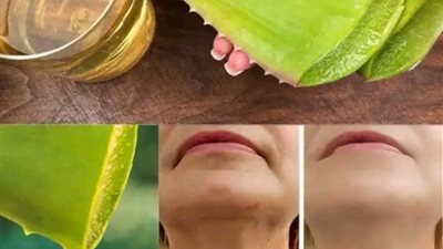 اقوى من البوتكس الصبار وفوائده للبشرة وإزالة التصبغات