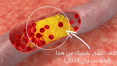 علاج الكوليسترول 