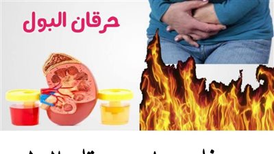 وصفات علاج حړقان البول 
