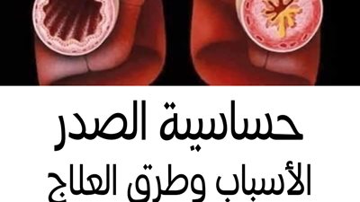 حساسية الصدر الاسباب وطرق علاجها 