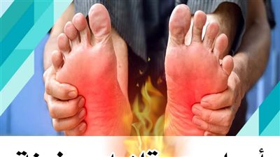 اسباب حړقان او سخونة القدم وكيفية التخلص من حرارة القدمين