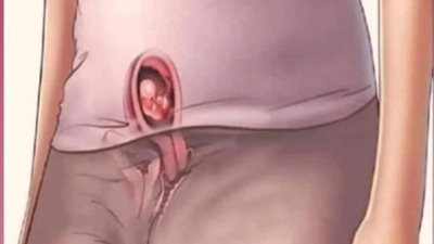 علامات تخبرك بانك حامل قبل التحليل