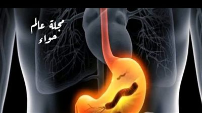 ما هي علامات تحول جرثومة المعدة إلى سړطان؟