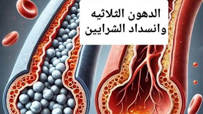 تحليل الدهون الثلاثية اسباب ارتفاع النتائج