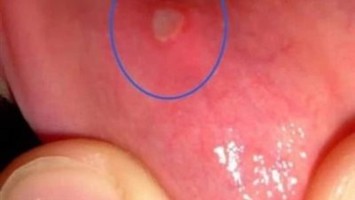 علامات تحذيرية في جسمك تدل ع حالة صحية خطېرة