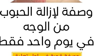 وصفات للتخلص من حبوب الوجه بسرعة 