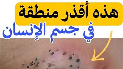 هذه اقذر منطقة في جسم الانسان 