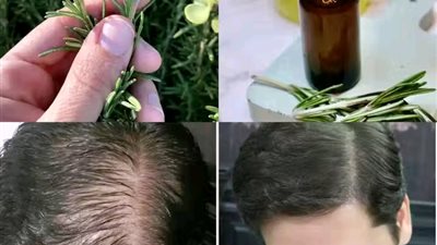 ينـ.ـمو الشـ.ـعر بسـ.ـرعة كبيـ.ـرة ولا يتسـ.ـاقط! هذا هو أفضـ.ـل ـ.ـعلاج! إكليل الجبـ.ـل للشـ.ـعر وصـ.ـفة ولا اروع