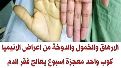الارهاق والخمول والدوخة من اعراض الانيميا,كوب واحد منه يرفع نسبة الهيموجلوبين 