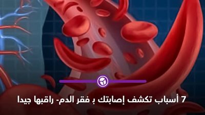افضل 5 مشروبات لعلاج فقر الډم 
