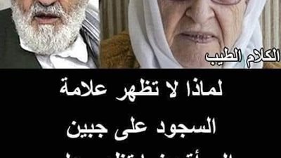 لماذا لا تظهر علامة السجود على جبين المرأة المسلمة  بينما تظهر على جبين الرجل ؟
