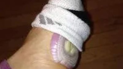 ماذا يحدث اذا وضعت قطعة من البصل اسفل قدمك.. اثناء النوم 