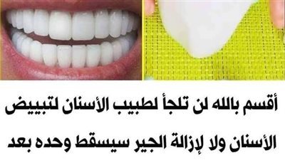أقسم بالله لن تلجأ لطـبيب الأسنان لتبييض الأسنان ولا لإزالـة الجير سيســقط وحده بعد المضمضة بهذا المحلول في دقيقتين 