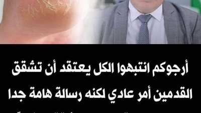 أرجوكم انتبهوا الكل يعتقد أن تشقق القدمين أمر عادي لكنه رسالة هامة جدا من الجســم اقضــي علي تشققات فورا