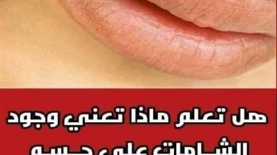 هل تعلم ماذا تعني وجود الشـامات على جــسـم الإنسان؟ 