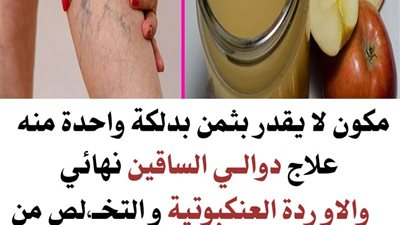 مكون لا يقدر بثمن بدلكة واحدة منه علاج دوالي الساقين نهائي والاوردة العنكـوتية و التخلص من الشعيـرات الدمويه البارزة في ايام   