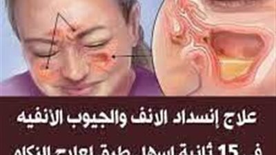 وصية ﷺالرسول لعلاج التـهابات و انسداد الجيوب الانفية في المنزل  