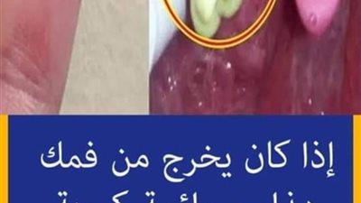 إذا كان يخرج من فمك هذا مع رائحة كريهة فالامر خطېر جدا لا تهمله