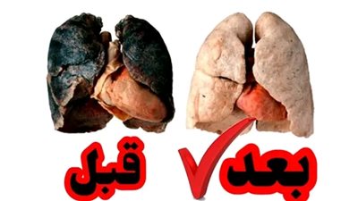 الطعام الوحيد الذي يقوم بحماية الرئتين من اثار الټدخين إحرص على أكله مرة يومياً فهذا موسمه