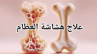 8 أعشاب تمنع نقص فتامين B12 الذي يؤدي إلى هشاشة العضام وتنميل اليدين والقدمين وصعوبة المشي!