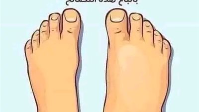 أقوى وصفة فعالة جدا ومجربة للتخلص من الاملاح الزائده في الجسم 