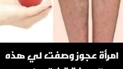علاج الدوالي بثمرة طماطم واحده