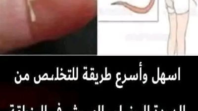 وصفة ليوم واحد وسترى الديدان تخرج من أمعائك وتنظف القولون 