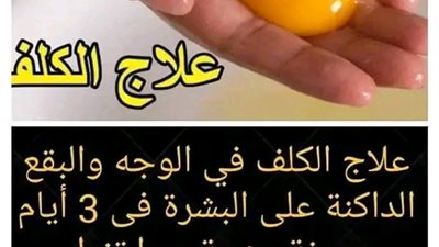 علاج الكلف في الوجه والبقع الداكنه على البشرة في ثلاث ايام