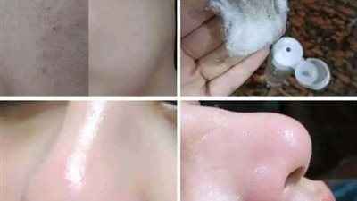 الفازلين والقرنفل لتبيض الجسم والبشرة