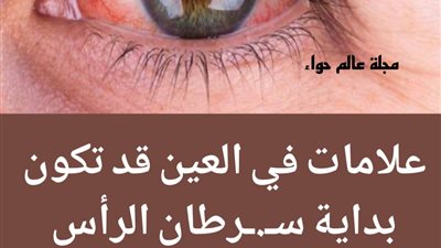 علامات في العين قد تكون بداية سړطان الرأس