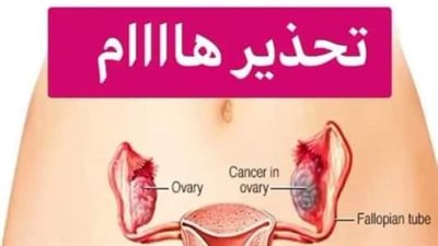 10 اشياء تودي الي سړطان الرحم 