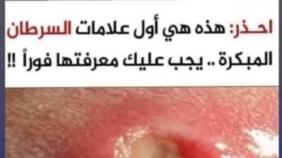 هذه هي اول علامات السړطان المبكرة 