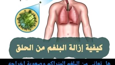 أفضل عــلاج لطـرد البلغـم سريعاً، عـلاج البلغم في الحــلق والصـدر بطرق طبيعية للكبـار و الأطـــفال 