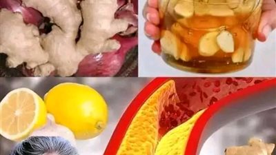 كيفــية تفتــيح الشــرايين من الدهـون المتراكـمة