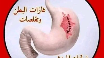 اعراض القولون العصبى وجرثومة المعدة