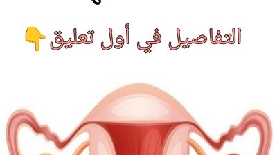 سړطان المبايض