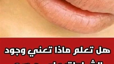 هل تعلم ماذا يعني وجود الشامات على جسم الانسان 
